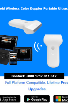 Handheld Wireless Color Doppler Portable Ultrasound