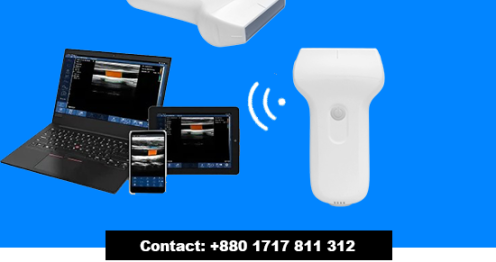 Handheld Wireless Color Doppler Portable Ultrasound