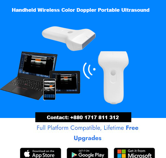 Handheld Wireless Color Doppler Portable Ultrasound