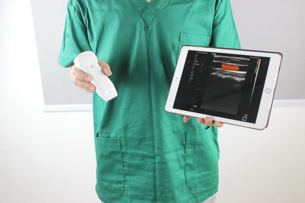 Handheld Ultrasound Moving Beyond Stethoscope?