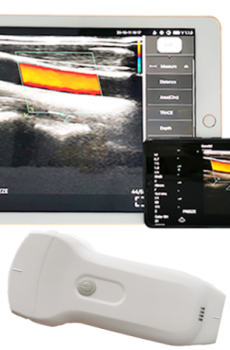 Double Probes Handheld Ultrasound Scanners (Convex+Phased+Linear Array)