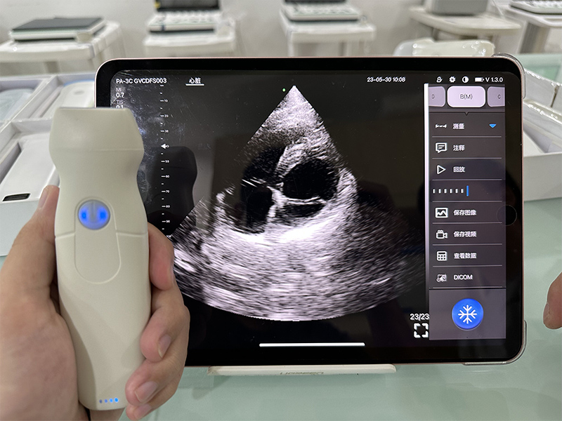 Handheld-Wireless-Color-Doppler-Ultrasound-Special-for-Cardiologist