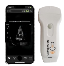 Portable Ultrasound Machine Price 2024 in Bangladesh: Everything You Need to Know