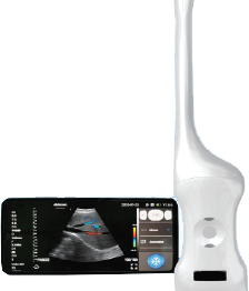 Handheld Wireless Portable Ultrasound