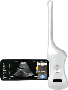 Wireless Ultrasound for Gynecology