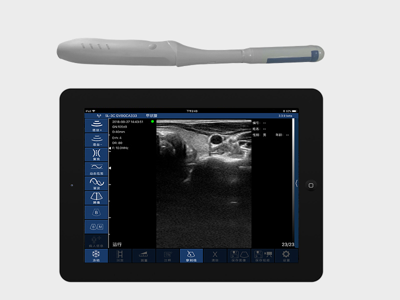 Application & Benefits of Endorectal Handheld Wireless Color Doppler Ultrasound