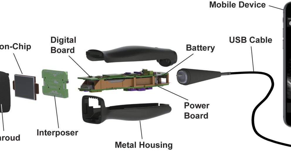 wireless ultrasound