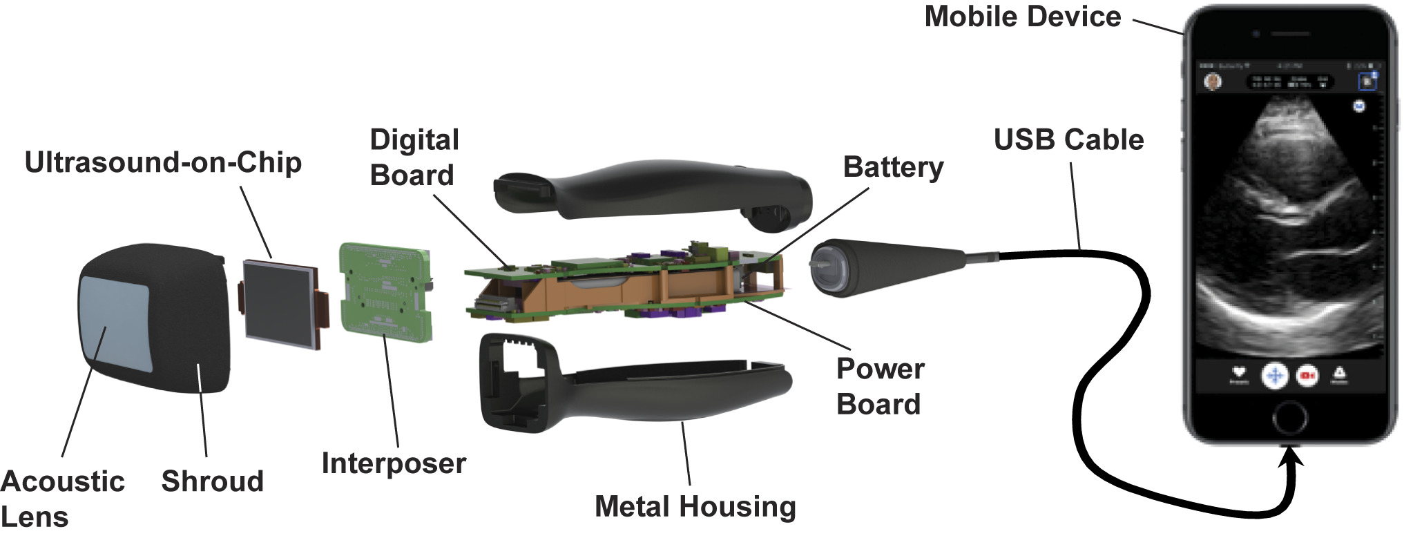 wireless ultrasound