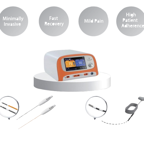 radiofrequency-ablation-of-haemorrhoids-fistula-under-local-anaesthesia