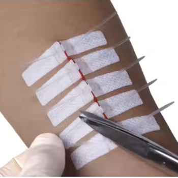 Wound Closure Devices