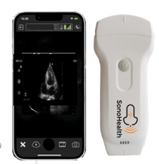 Wireless Ultrasound