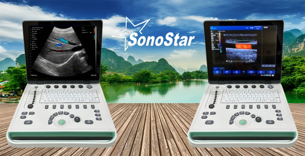 Ultrasound Machine
