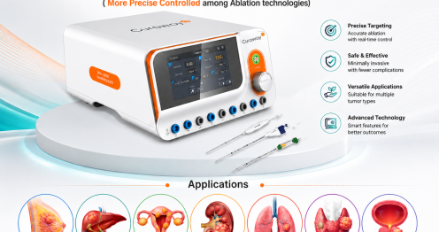 Radiofrequency Ablation System for Tumors