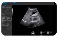 Digitat AI-Powered Color Doppler Auto ABD-Analysis Usg