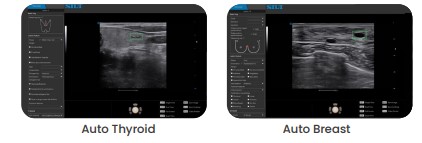 Digitat AI-Powered Color Doppler Auto Thyroid Auto Breast Usg