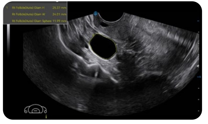 Best Portable Point of Care Ultrasound