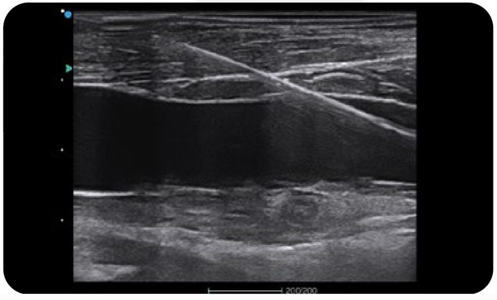Best Portable Point of Care Ultrasound
