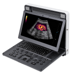 Best Portable Point of Care Ultrasound