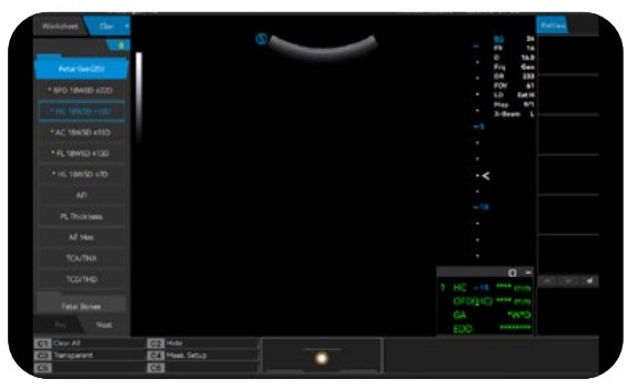 Best Portable Point of Care Ultrasound